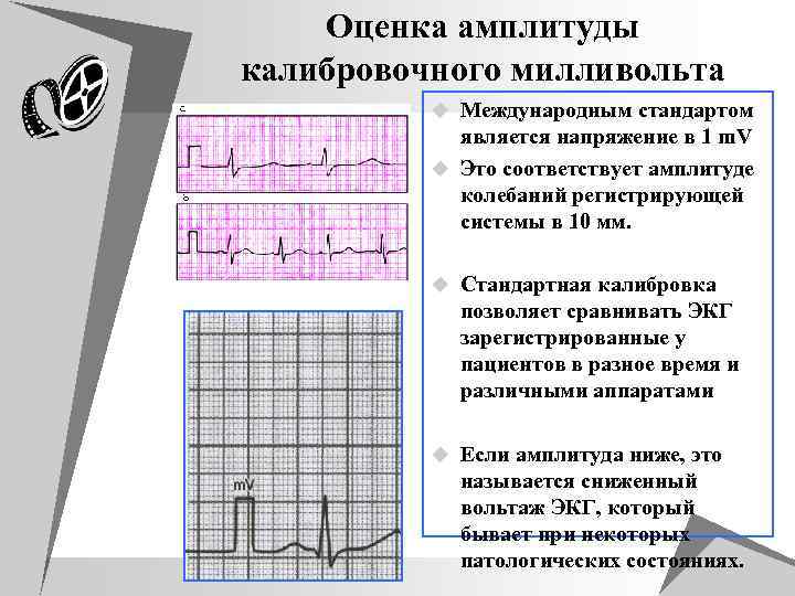 Оценка амплитуды калибровочного милливольта u Международным стандартом является напряжение в 1 m. V u