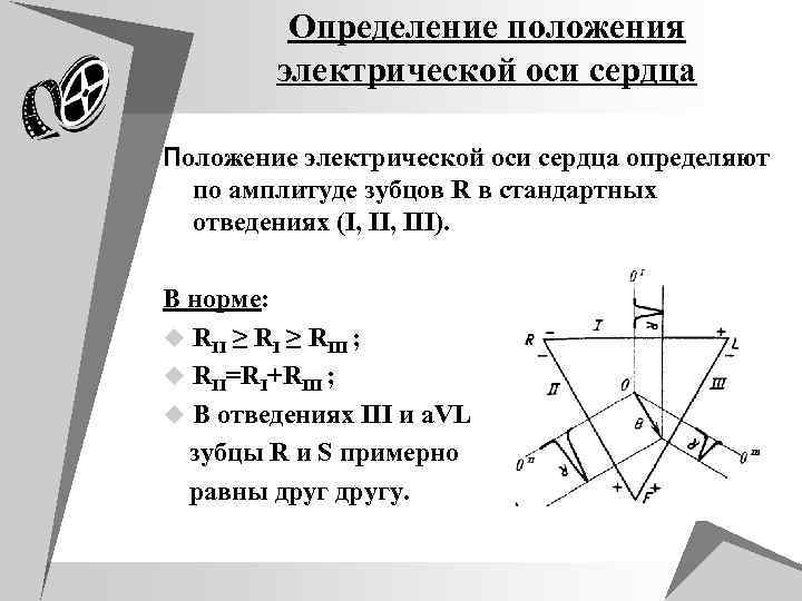 Эос экг картинки