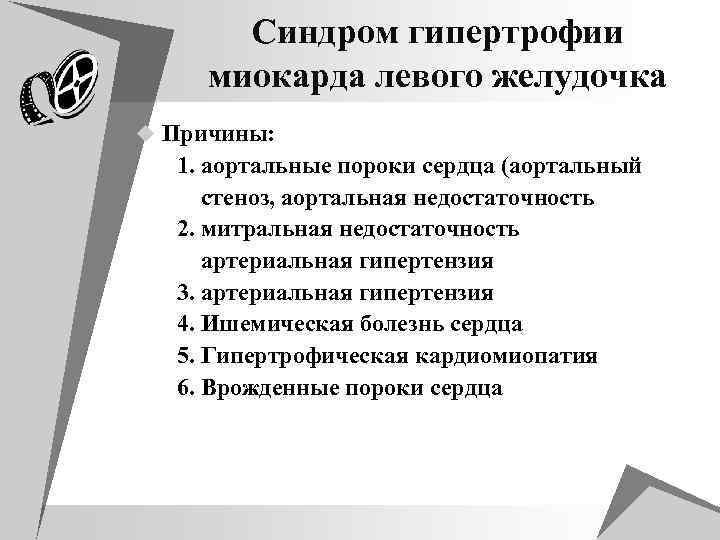 Синдром гипертрофии миокарда левого желудочка u Причины: 1. аортальные пороки сердца (аортальный стеноз, аортальная