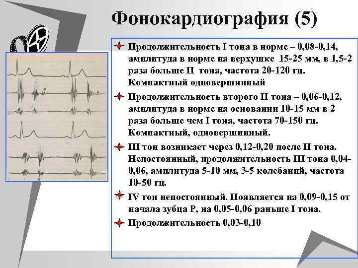 Регистрация сердца. ФКГ принцип метода. Фонокардиография метод регистрации показатели. Фонокардиограмма амплитуда. Фонокардиограмма тоны сердца.