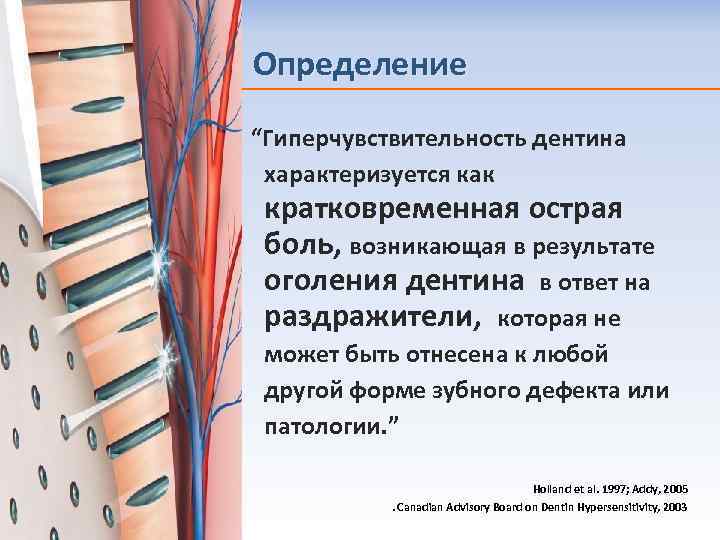 Определение “Гиперчувствительность дентина характеризуется как кратковременная острая боль, возникающая в результате оголения дентина в