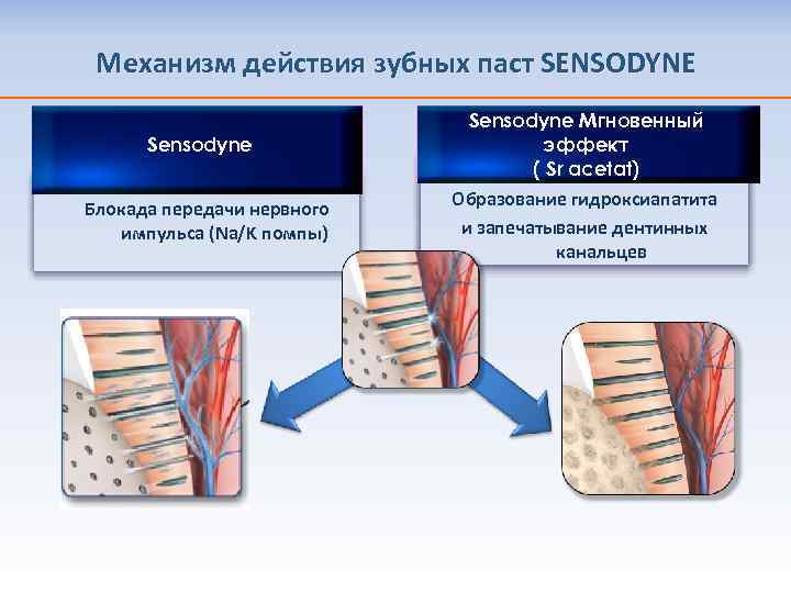 Механизм действия зубных паст SENSODYNE Sensodyne Блокада передачи нервного импульса (Na/K помпы) Sensodyne Мгновенный