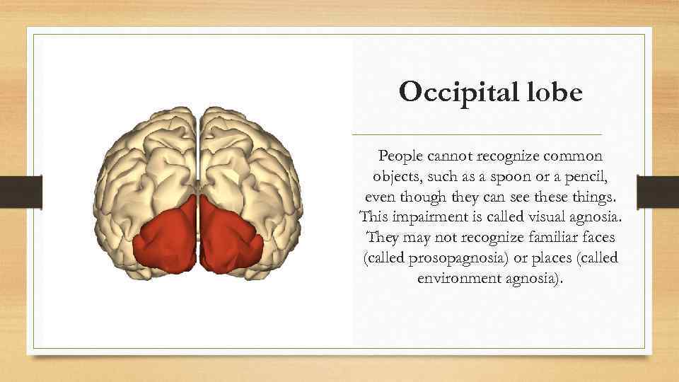 Occipital lobe People cannot recognize common objects, such as a spoon or a pencil,
