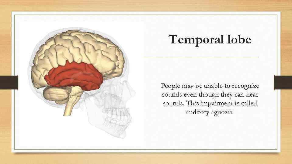 Temporal lobe People may be unable to recognize sounds even though they can hear
