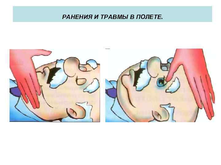 РАНЕНИЯ И ТРАВМЫ В ПОЛЕТЕ. 