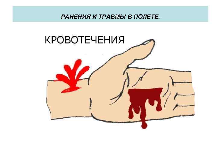 РАНЕНИЯ И ТРАВМЫ В ПОЛЕТЕ. 