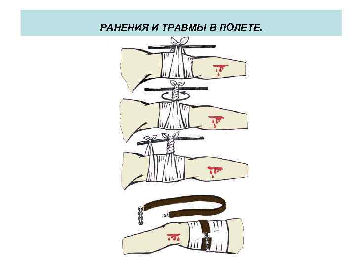 РАНЕНИЯ И ТРАВМЫ В ПОЛЕТЕ. 