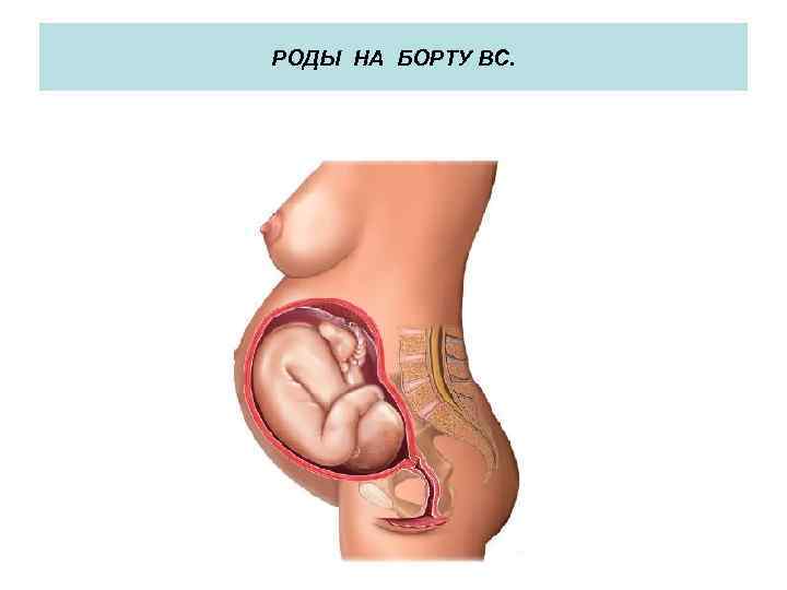 РОДЫ НА БОРТУ ВС. 