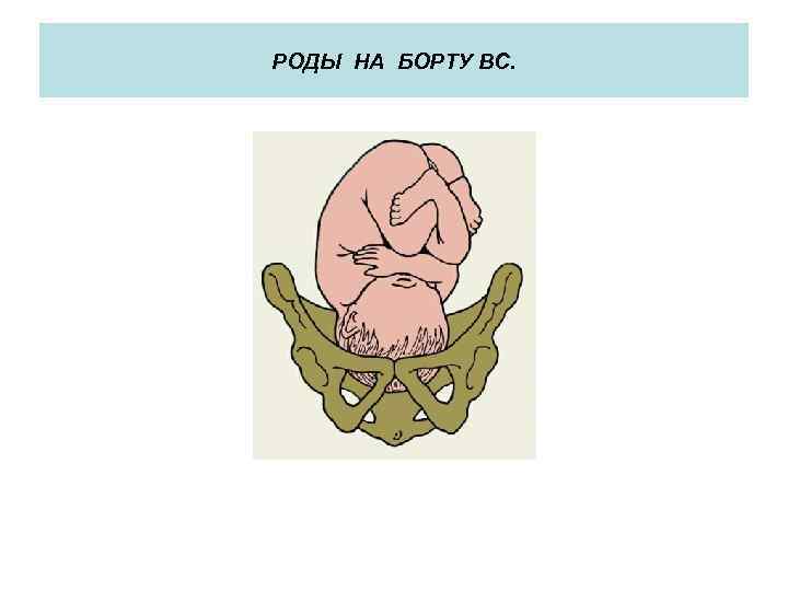 РОДЫ НА БОРТУ ВС. 