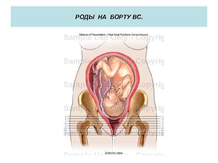 РОДЫ НА БОРТУ ВС. 