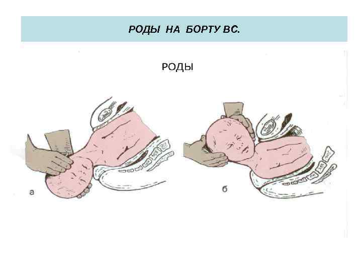 РОДЫ НА БОРТУ ВС. 