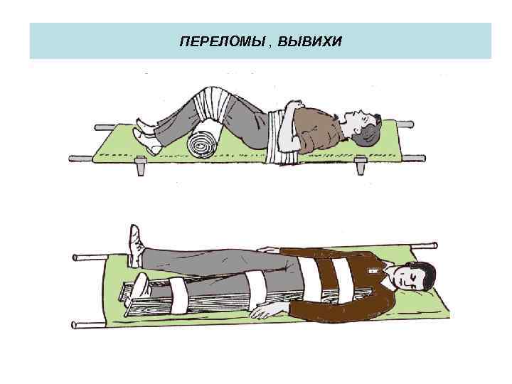 ПЕРЕЛОМЫ , ВЫВИХИ 