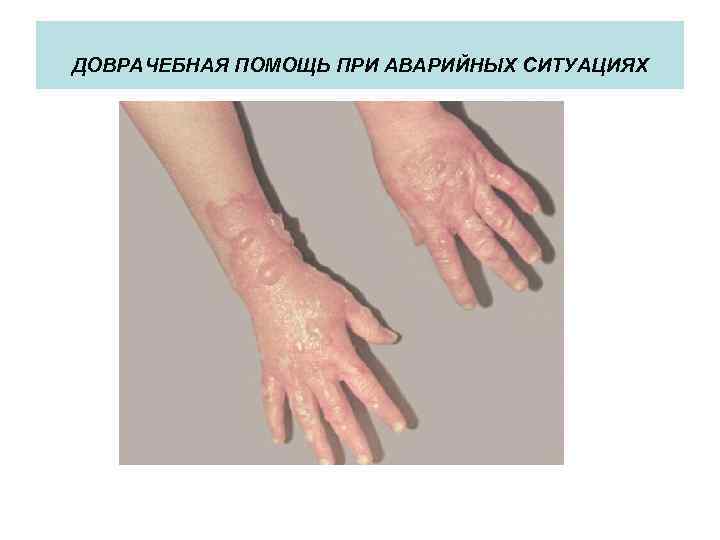 ДОВРАЧЕБНАЯ ПОМОЩЬ ПРИ АВАРИЙНЫХ СИТУАЦИЯХ 