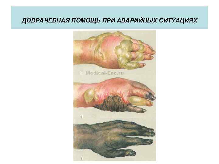 ДОВРАЧЕБНАЯ ПОМОЩЬ ПРИ АВАРИЙНЫХ СИТУАЦИЯХ 