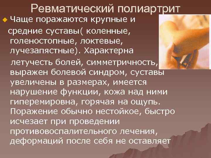 Ревматический полиартрит Чаще поражаются крупные и средние суставы( коленные, голеностопные, локтевые, лучезапястные). Характерна летучесть