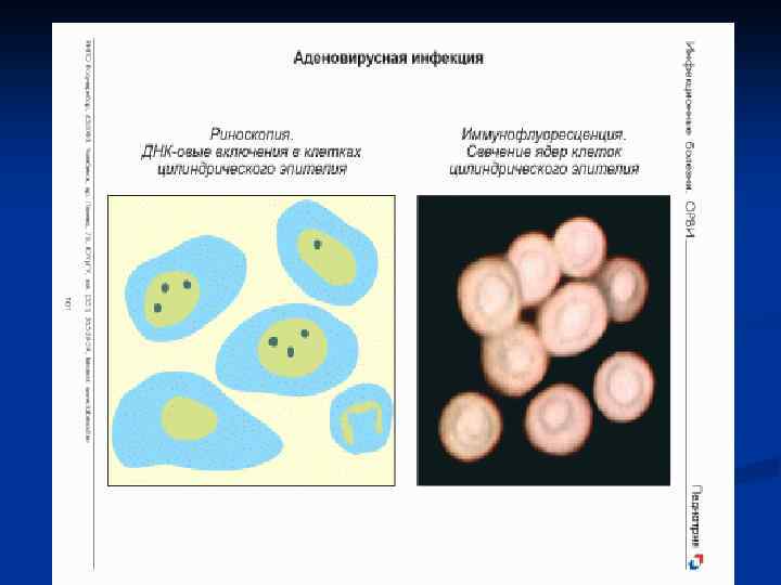 Сестринская карта по инфекции