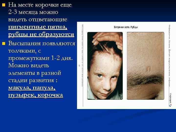 n n На месте корочки еще 2 -3 месяца можно видеть отцветающие пигментные пятна,