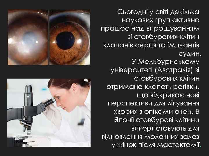 Сьогодні у світі декілька наукових груп активно працює над вирощуванням зі стовбурових клітин клапанів