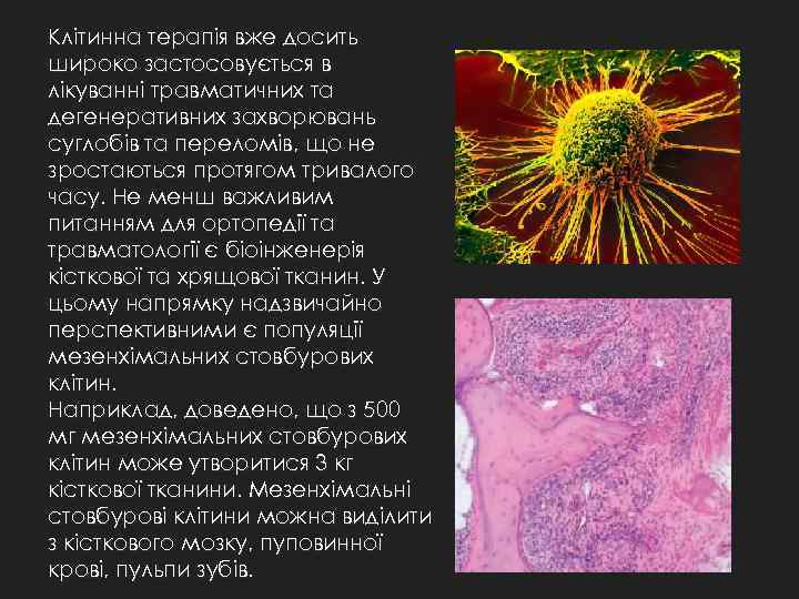 Клітинна терапія вже досить широко застосовується в лікуванні травматичних та дегенеративних захворювань суглобів та