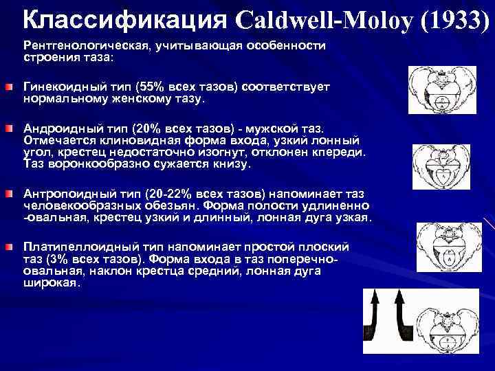 Классификация Caldwell-Moloy (1933) Рентгенологическая, учитывающая особенности строения таза: Гинекоидный тип (55% всех тазов) соответствует