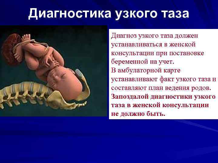Диагностика узкого таза Диагноз узкого таза должен устанавливаться в женской консультации при постановке беременной