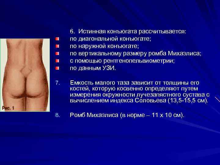 6. Истинная конъюгата рассчитывается: по диагональной конъюгате; по наружной конъюгате; по вертикальному размеру ромба
