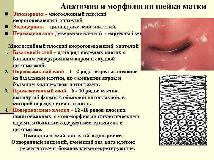 Анатомия и морфология шейки матки n Экзоцервикс - многослойный плоский неороговевающий эпителий n Эндоцервикс