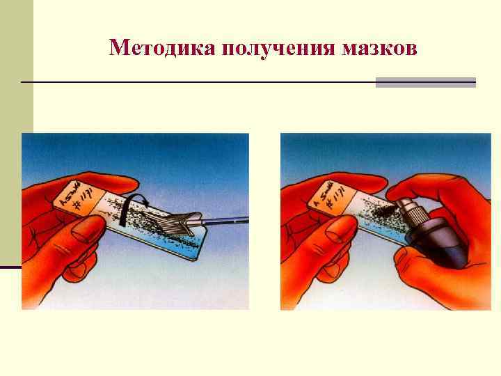Методика получения мазков 