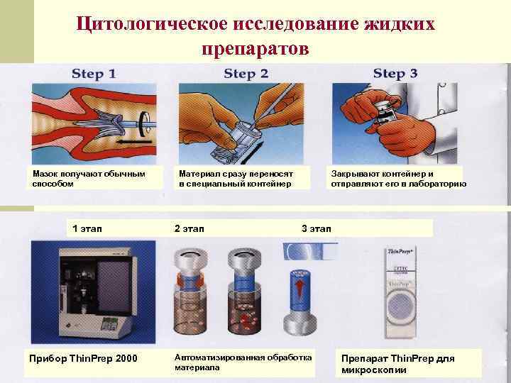 Цитологическое исследование жидких препаратов 1 этап Мазок получают обычным способом 1 этап Прибор Thin.