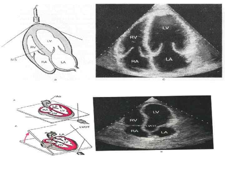 Эхокардиография в таблицах и схемах рыбакова митьков