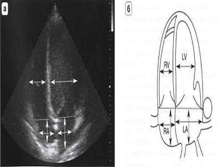 Эхокардиография в таблицах и схемах рыбакова митьков