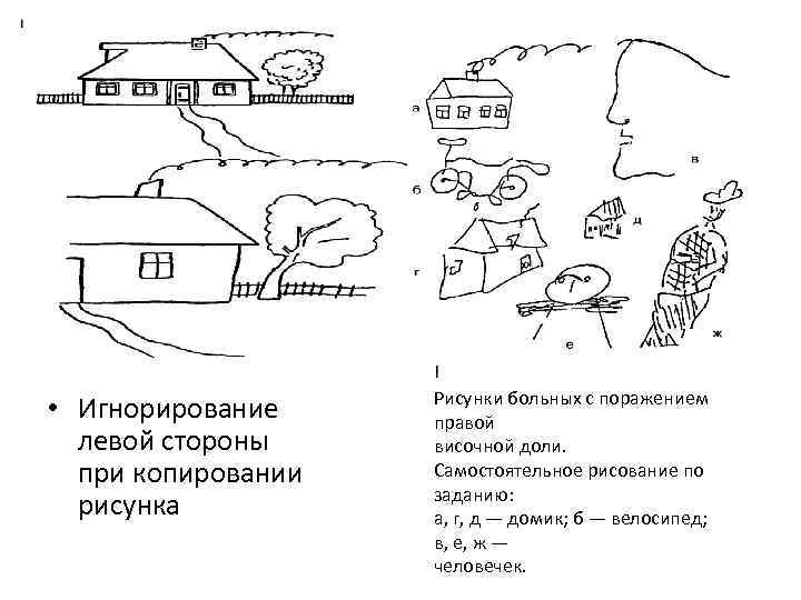  • Игнорирование левой стороны при копировании рисунка Рисунки больных с поражением правой височной