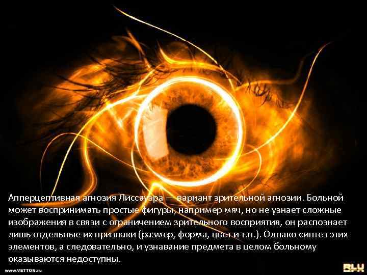 Апперцептивная агнозия Лиссауэра — вариант зрительной агнозии. Больной может воспринимать простые фигуры, например мяч,