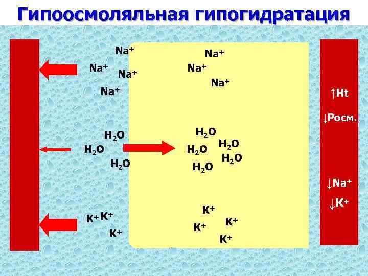 Гипоосмоляльная гипогидратация Na+ Na+ ↑Ht ↓Росм. Н 2 О Н 2 О ↓Na+ К