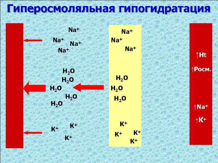 Гиперосмоляльная гипогидратация Na+ Na+ Н 2 О К+ Na+ Na+ ↑Ht ↑Росм. Н 2