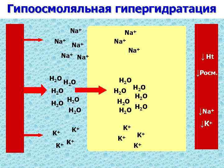 Гипоосмоляльная гипергидратация Na+ Na+ Н 2 О Н 2 О К+ К+ ↓Росм. Н