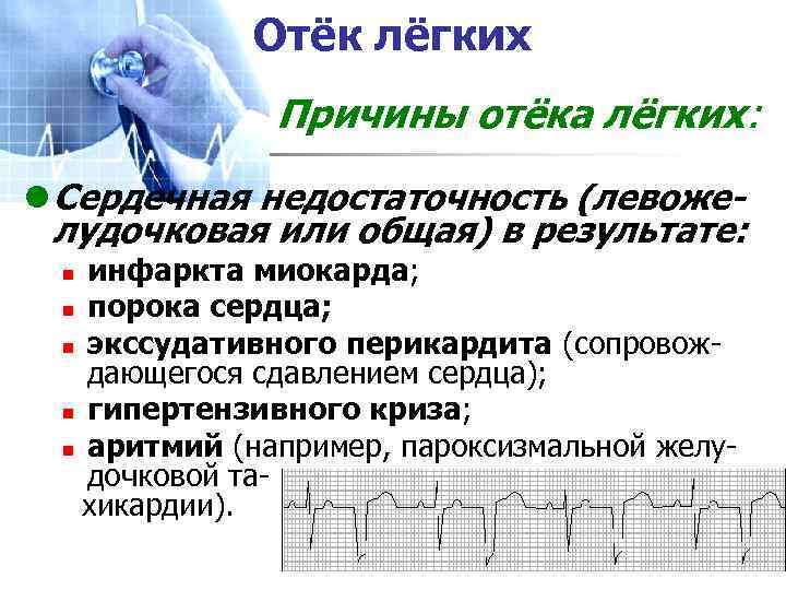 Отёк лёгких Причины отёка лёгких: l Сердечная недостаточность (левожелудочковая или общая) в результате: инфаркта