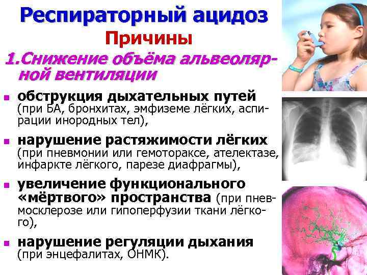 Респираторный ацидоз Причины 1. Снижение объёма альвеолярной вентиляции n обструкция дыхательных путей n нарушение