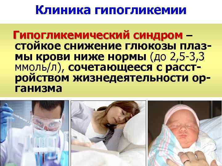 Клиника гипогликемии Гипогликемический синдром – стойкое снижение глюкозы плазмы крови ниже нормы (до 2,