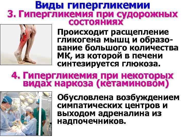 Виды гипергликемии 3. Гипергликемия при судорожных состояниях Происходит расщепление гликогена мышц и образование большого
