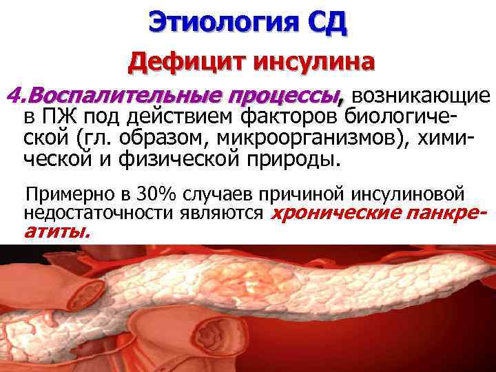 Этиология СД Дефицит инсулина 4. Воспалительные процессы, возникающие в ПЖ под действием факторов биологической