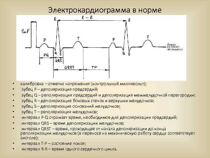 Электрокардиограмма в норме • • • калибровка – отметка напряжения (контрольный милливольт); зубец Р