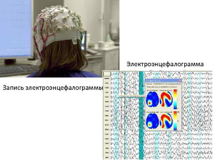 Электроэнцефалограмма Запись электроэнцефалограммы 