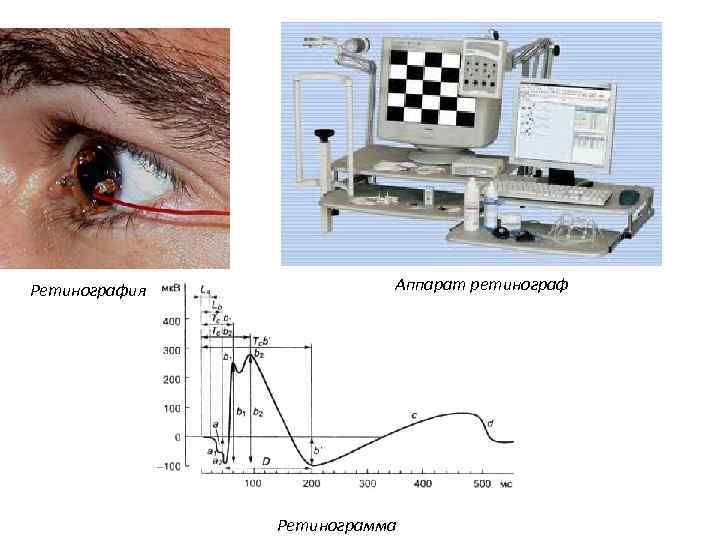 Ретинография Аппарат ретинограф Ретинограмма 