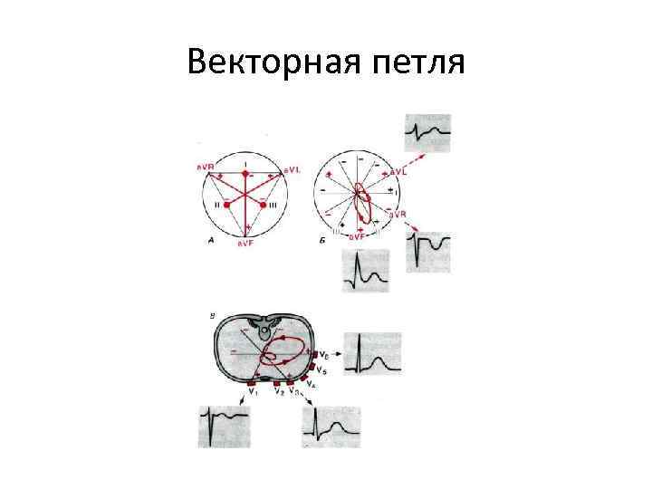 Векторная петля 
