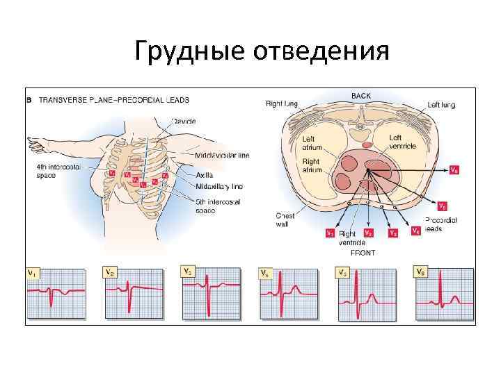Грудные отведения 