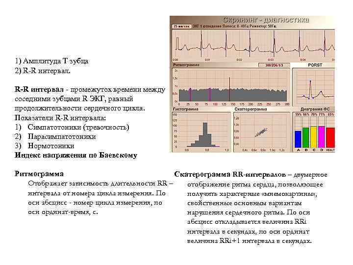 1) Амплитуда T зубца 2) R R интервал. R-R интервал промежуток времени между соседними