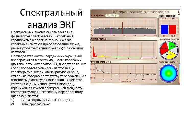 План анализа экг