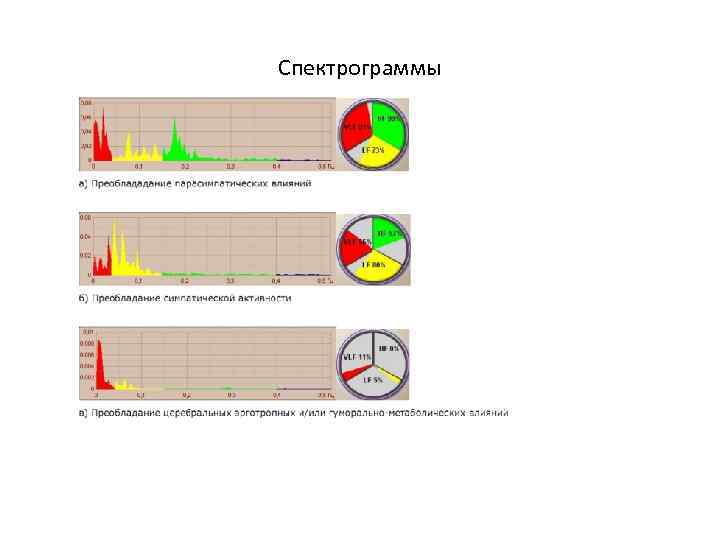 Спектрограммы 