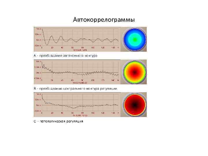Автокоррелограммы 
